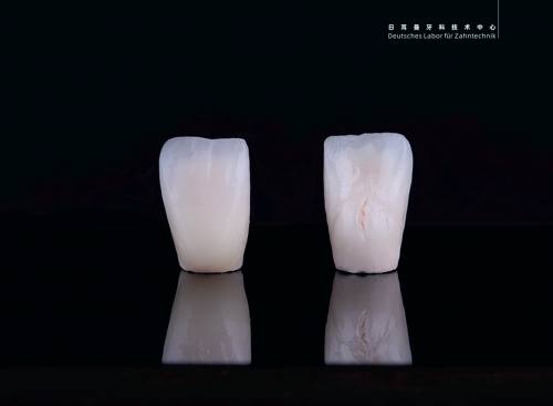 148道工序成就一顆德國(guó)精工好牙